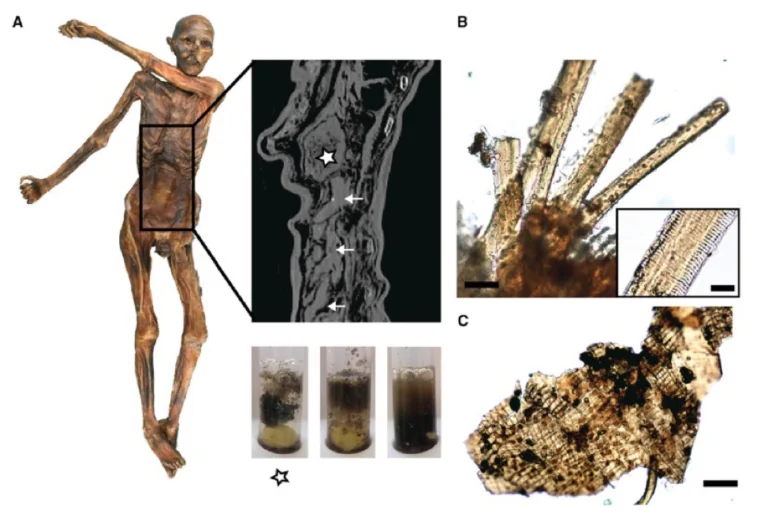 Ötzi1